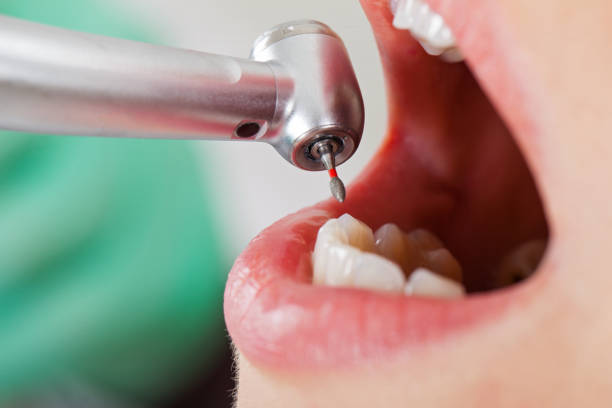 Best Emergency Dentist for Knocked-Out Tooth in Munford, TN